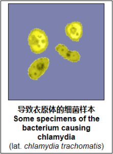 衣原体(可治愈性传播疾病)-性教育网