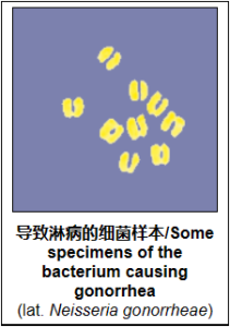 淋病(可治愈性传播疾病)-性教育网